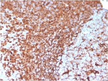 Vimentin Antibody
