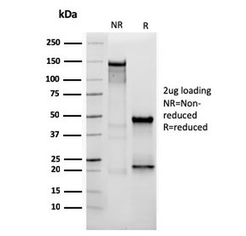 Vimentin Antibody