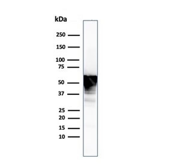 Vimentin Antibody