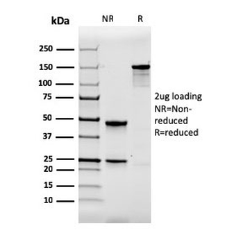 Calbindin Antibody / CALB1