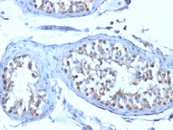 VTCN1 Antibody / B7H4