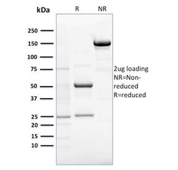 EBAG9 Antibody / Estrogen Receptor Binding Site Associated Antigen 9 / RCAS1