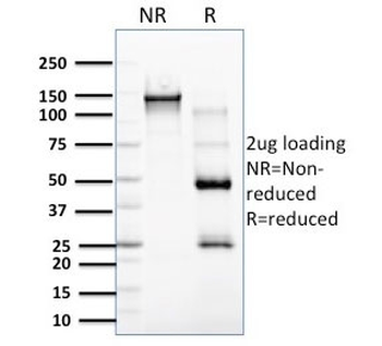 EBAG9 Antibody / Estrogen Receptor Binding Site Associated Antigen 9 / RCAS1