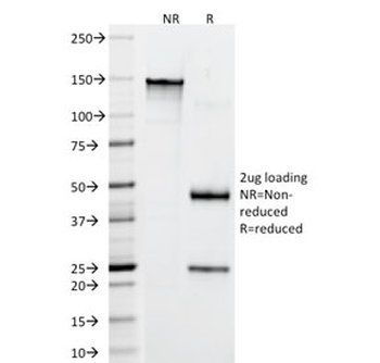 CD4 Antibody
