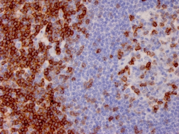 CD7 Antibody
