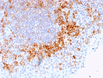 CD27 Antibody
