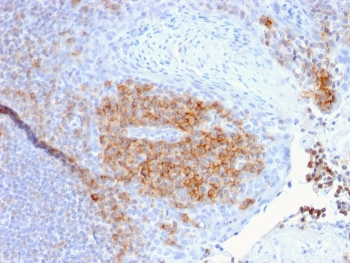 CD27 Antibody