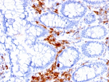 CD27 Antibody