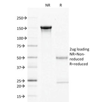 CD27 Antibody
