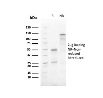 Recombinant ATG5 Antibody