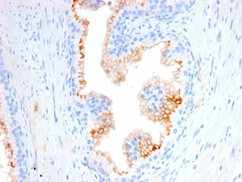 CD10 Antibody / Neprilysin