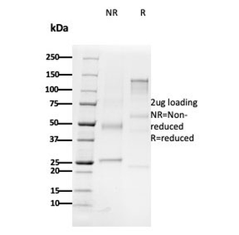 CD79b Antibody