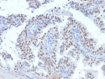 RET Antibody / c-RET
