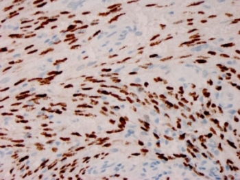 Herpes Virus 8 Antibody