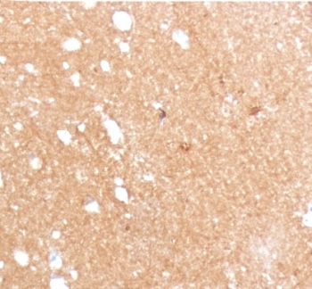 Beta Tubulin Antibody / TUBB3