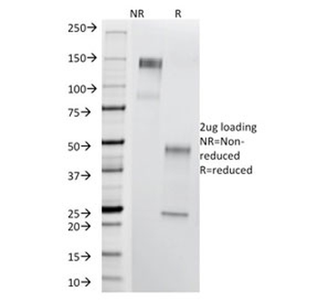 Thomsen-Friedenreich Antigen Antibody / CD176