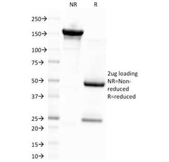 EBV Antibody / Epstein-Barr Virus