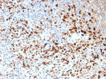 HSV1 Antibody / Herpes Simplex Virus Type I