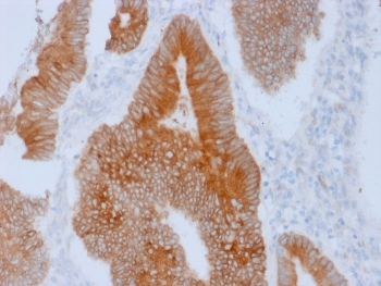 Aurora B Antibody / AURKB