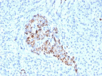 Chromogranin A Antibody / CHGA
