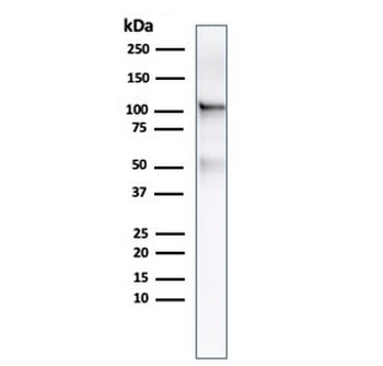 Folate Hydrolase 1 Antibody / FOLH1 / PSMA