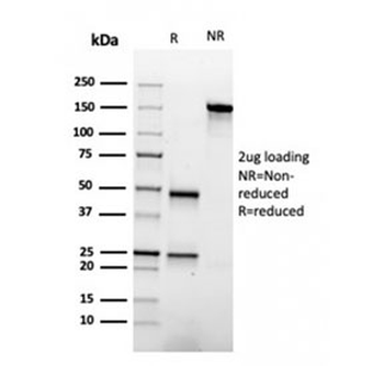 Apolipoprotein A I Antibody / APOA1