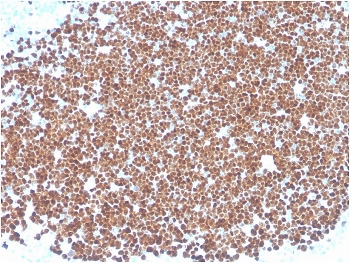 TdT Antibody