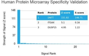 TdT Antibody