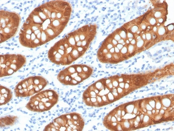 Recombinant Villin Antibody