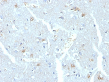 UBE2C Antibody
