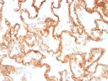Integrin beta 1 Antibody / ITGB1 / CD29