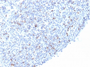 Recombinant ITGAE Antibody / Integrin alpha E / CD103
