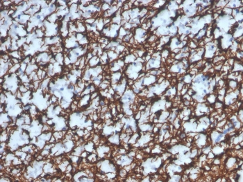 Recombinant Myelin Basic Protein Antibody
