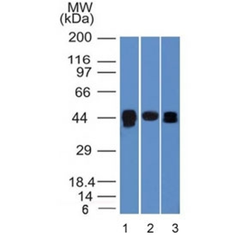 TIA-1 Antibody / T-Cell Intracellular Antigen-1