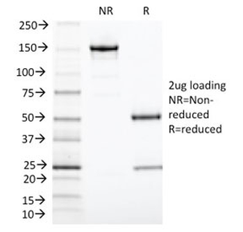 TIA-1 Antibody / T-Cell Intracellular Antigen-1