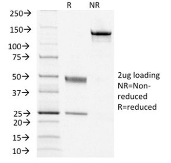 CD79a Antibody