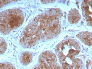 FGF21 Antibody / Fibroblast Growth Factor 21