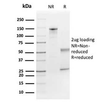 FGF21 Antibody / Fibroblast Growth Factor 21