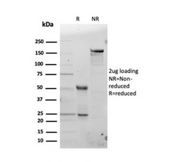 FTL Antibody / Ferritin Light Chain