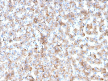 APOB Antibody / Apolipoprotein B