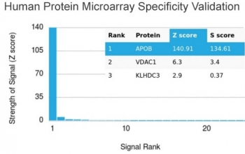 APOB Antibody / Apolipoprotein B