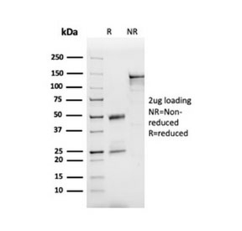 APOB Antibody / Apolipoprotein B