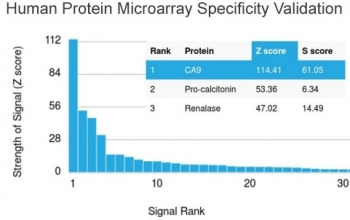 Carbonic Anhydrase IX Antibody / CA9