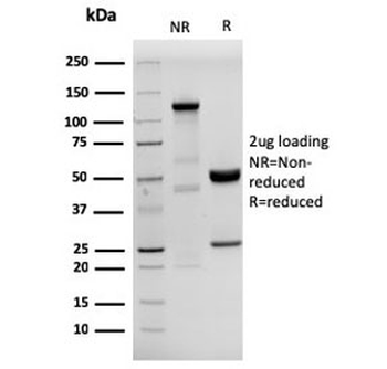 HHV8 Antibody / Human Herpes Virus 8