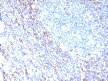 Recombinant ZAP70 Antibody
