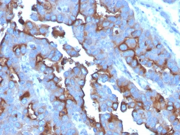 Transferrin Receptor Antibody / TFRC / CD71