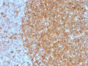 Transferrin Receptor Antibody / TFRC / CD71