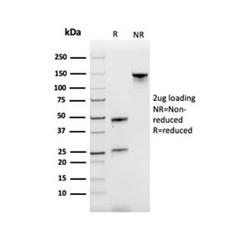 Transferrin Receptor Antibody / TFRC / CD71