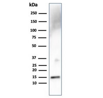 Transthyretin Antibody / TTR / Prealbumin