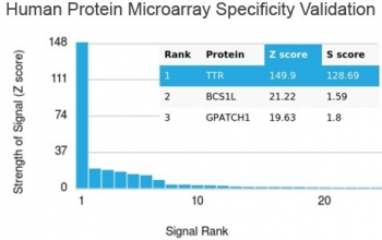 Transthyretin Antibody / TTR / Prealbumin